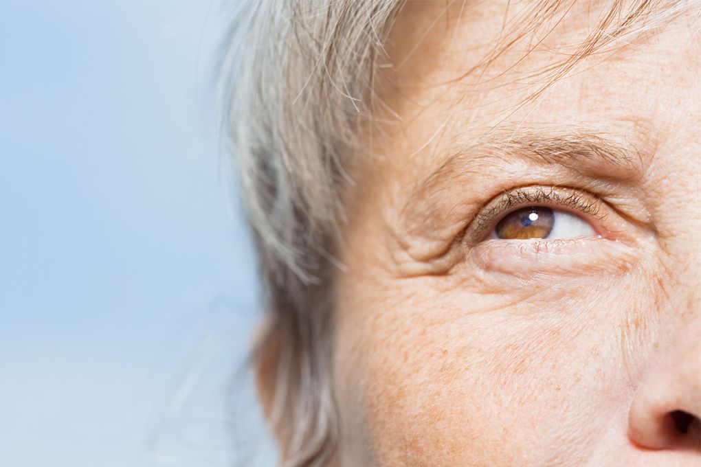 Non Surgical Fixes For Eye Wrinkles Bags And Droopy Lids The