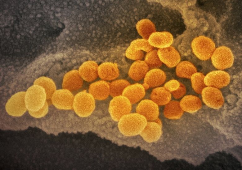 This is an electron microscope image of a lab culture shows novel coronavirus SARS-CoV-2 (orange), emerging from the surface of cells (gray).   (NIAID-RML via AP)