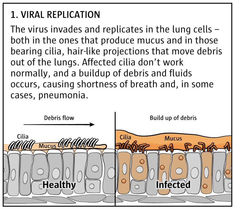 Facts about novel coronavirus and how to prevent COVID-19 | The Seattle  Times